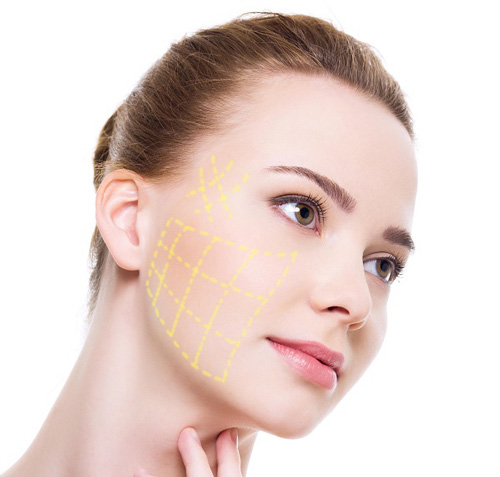 căng da mặt bằng chỉ vàng có hiệu quả trẻ hóa vượt trội