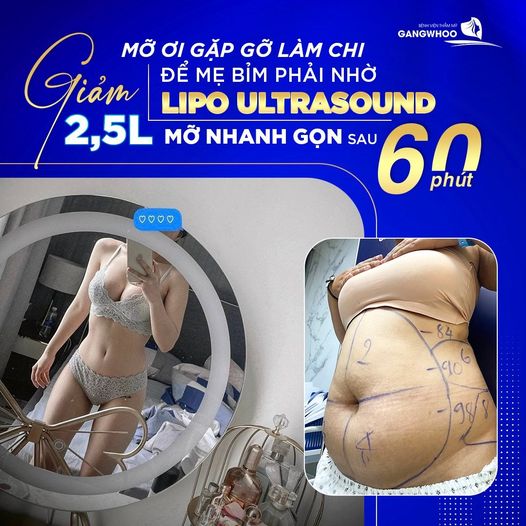 Hút Mỡ Công Nghệ Cao Lipo Ultrasound - Mang Đến Sự An Tâm Cho Mọi Khách Hàng