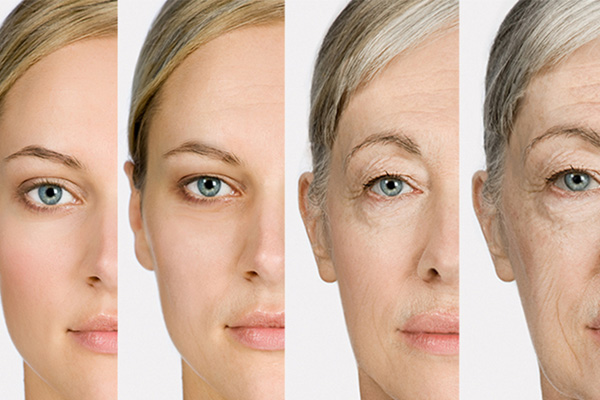 Căng chỉ da mặt phù hợp với tình trạng lão hoá cấp độ nhẹ hoặc trung bình