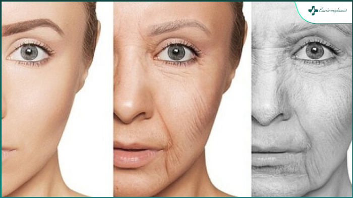 Căng chỉ da mặt chỉ phù hợp với những người có mức độ lão hoá từ nhẹ đến trung bình